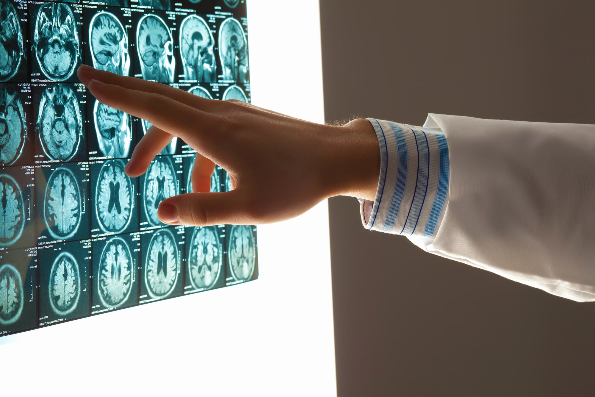 Lake Worth Brain Injury Lawyer