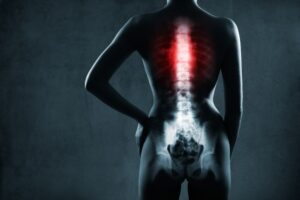 Lake Worth Spinal Cord Injury Lawyer
